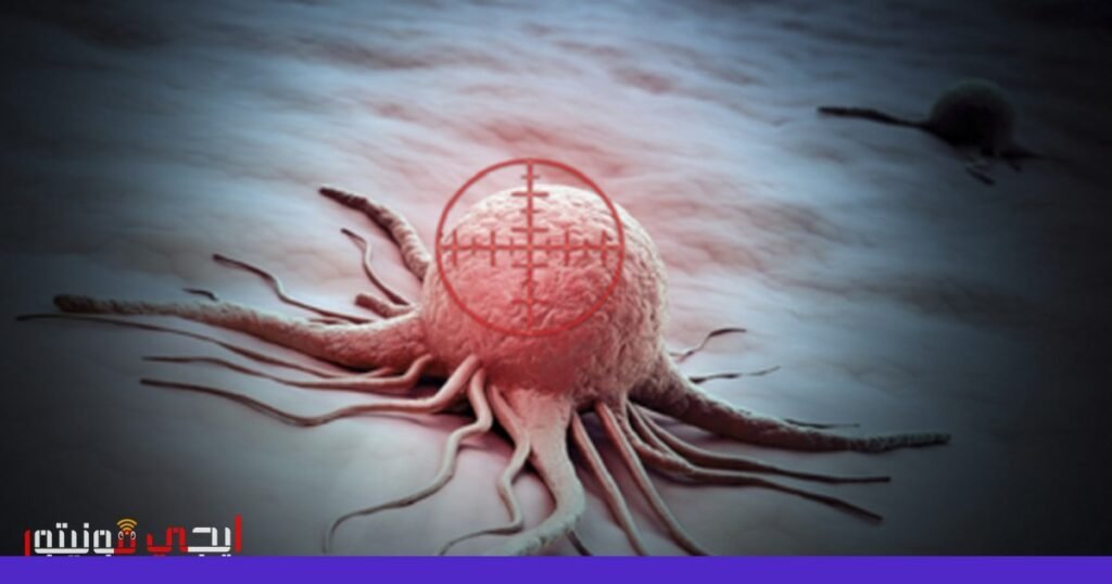 صورة: تشخيص السرطان